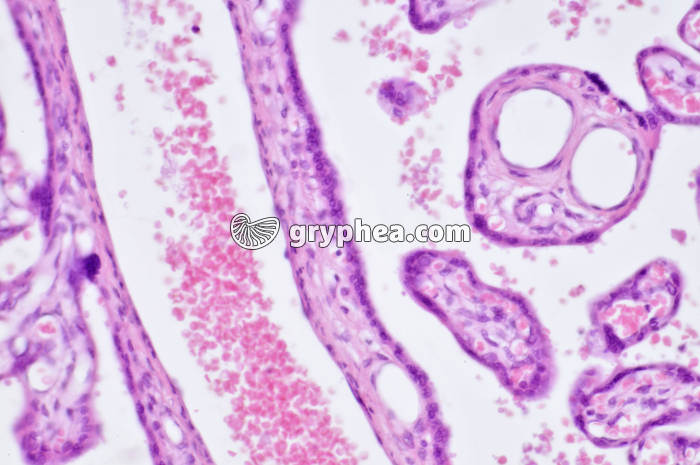 Placenta humain x100 - gryphea.org